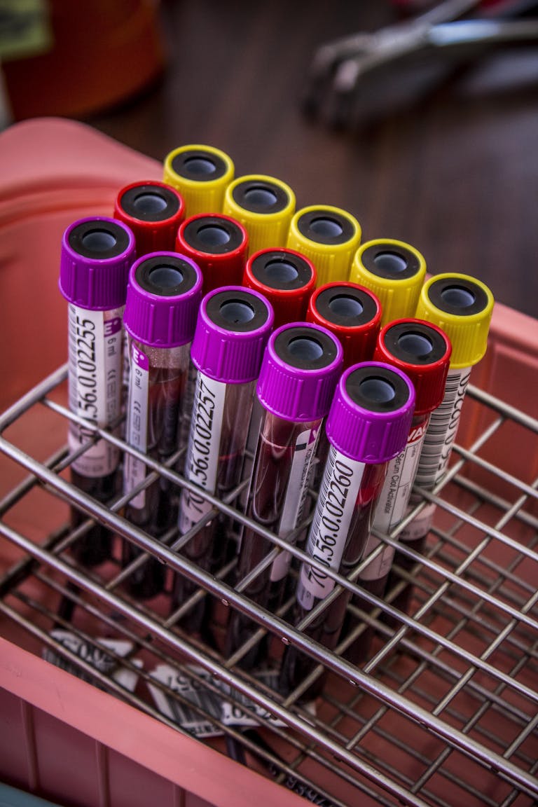 Close-up of colorful blood test tubes in a metal rack for laboratory analysis.